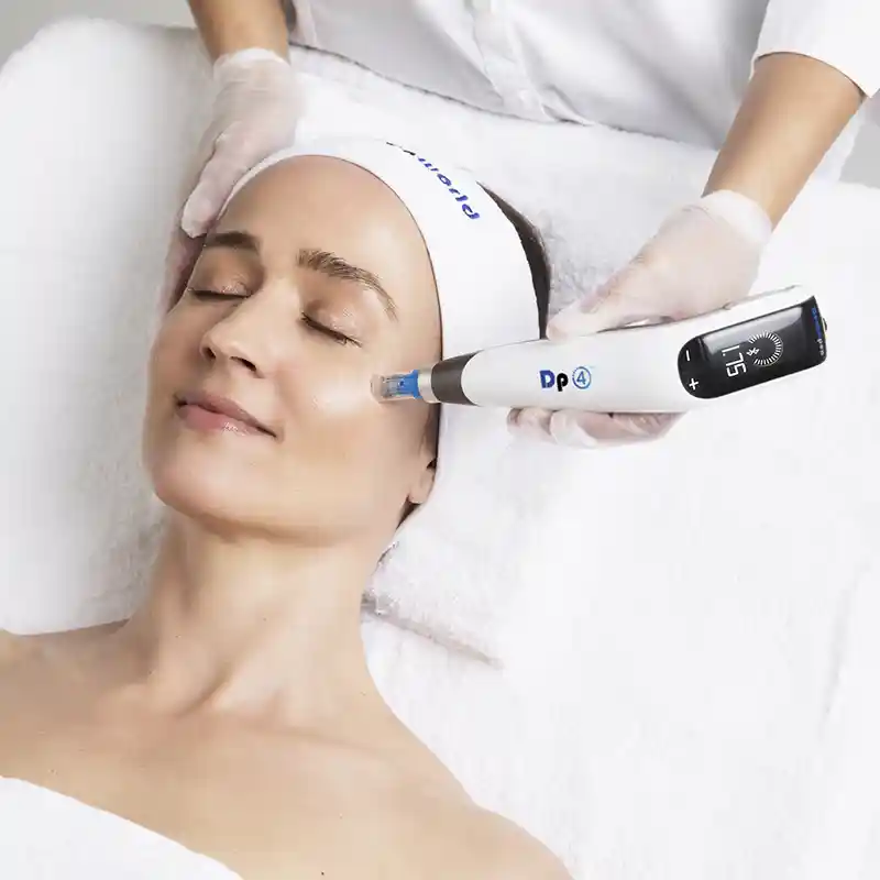 Indianapolis microneedling treatment